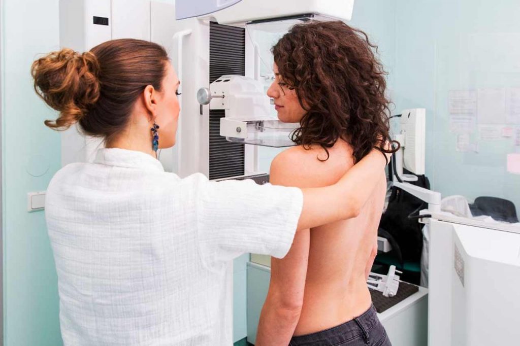 Mammography