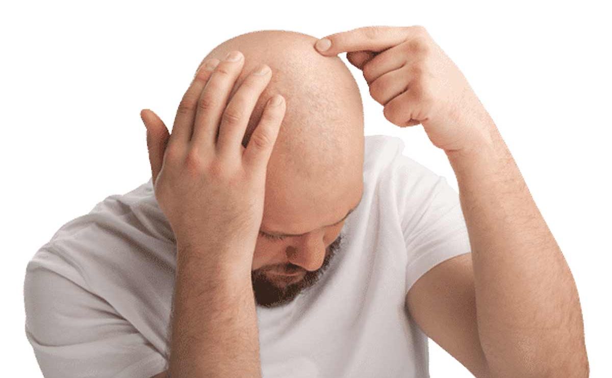 Bald diseases :: Host and Care