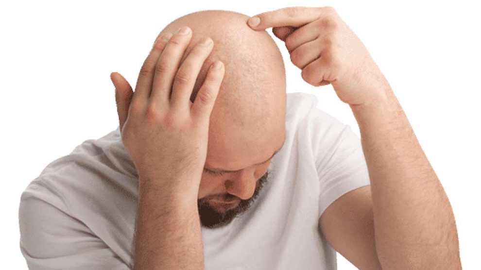Bald diseases :: Host and Care