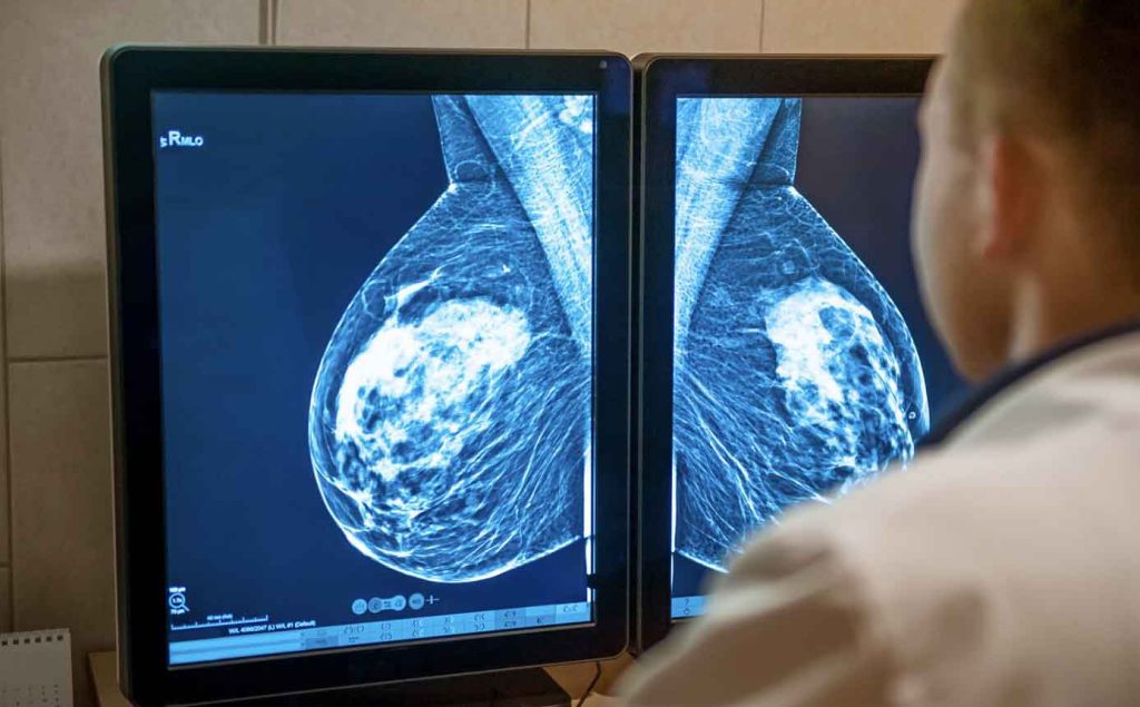 what is Mammography?