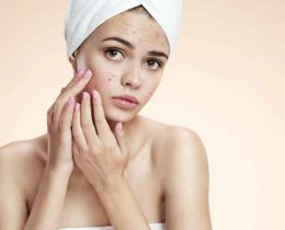 Pimple Acne symptoms and treatment host and care